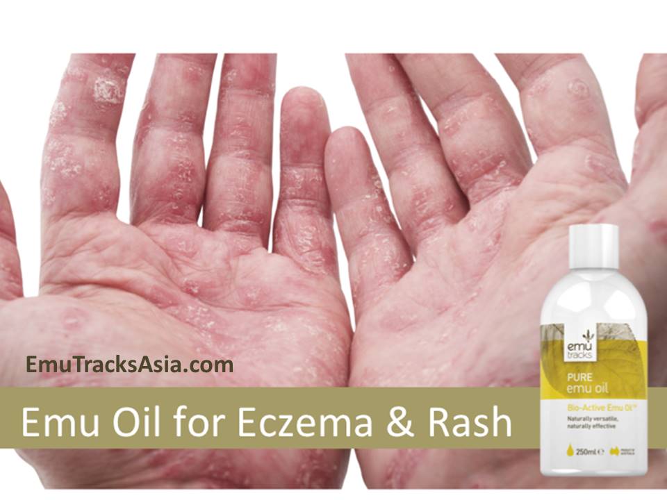 Emu oil coupon